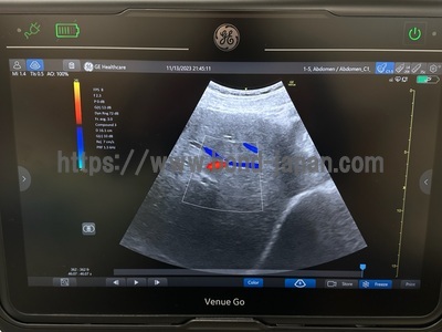 Ultrasound | GE | Venue Go