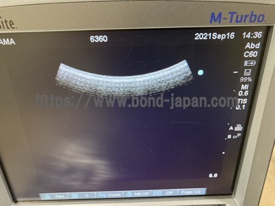 超音波診断装置/カラードプラ | 株式会社富士フイルムソノサイト | M-Turboの写真
