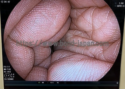 上部消化管経鼻用ビデオスコープ | 富士フイルムメディカル株式会社 | EG-580NW2の写真