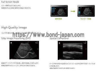 【新品】超音波診断装置 | 富士フイルムヘルスケア | ARIETTA Prologueの写真