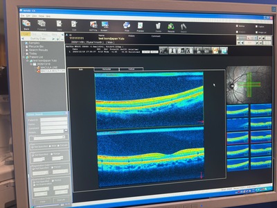 Retinal Camera and OCT Combined|NIDEK|RS-3000