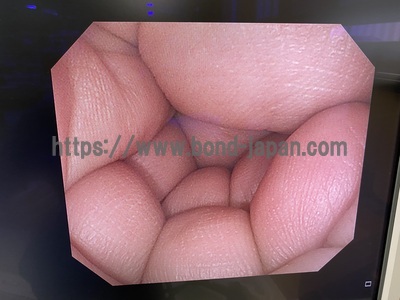 大腸ビデオスコープ&nbsp;|&nbsp;オリンパス&nbsp;|&nbsp;CF-Q260AIの写真