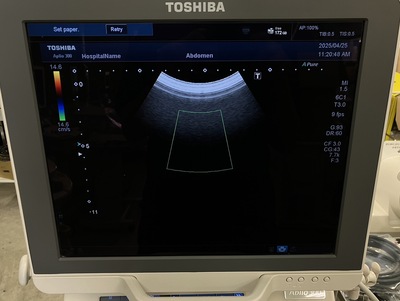 Color Doppler|CANON|Aplio 300