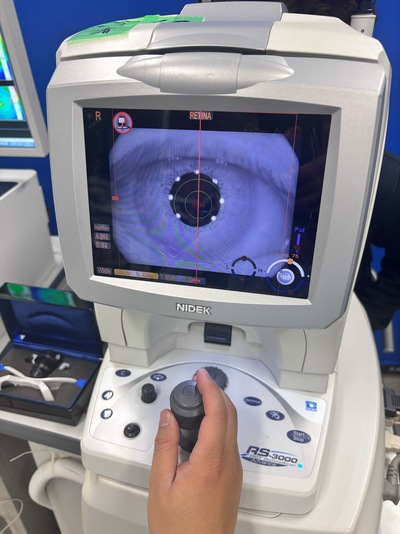 Optical Coherence Tomography・OCT|NIDEK|RS-3000 Advance