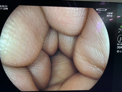 Video Gastroscope&nbsp;|&nbsp;FUJIFILM&nbsp;|&nbsp;EG-L600ZW7