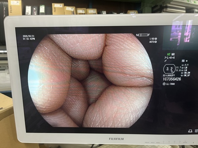 Colonoscope&nbsp;|&nbsp;FUJIFILM&nbsp;|&nbsp;EC-L600ZP7