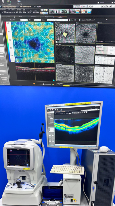 ANGIOGRAPHY installed OCT|NIDEK|RS-3000 Advance