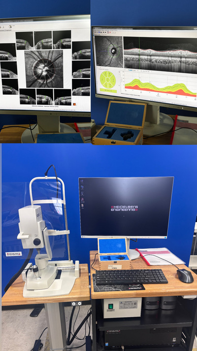 OCT|Heidelberg Engineering GmbH|SPECTRALIS OCT2