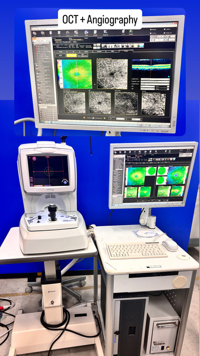 Fully Refurbished OCT with Angiography + Anterior Lens kit|NIDEK|RS-3000 Advance