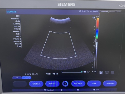 Color Doppler&nbsp;|&nbsp;SIEMENS&nbsp;|&nbsp;X300 PE