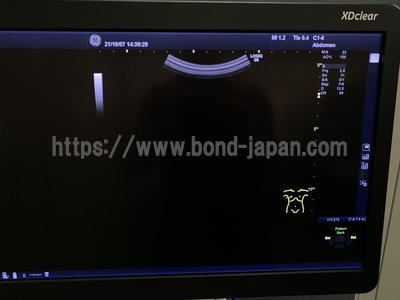 超音波診断装置/カラードプラ &nbsp;|&nbsp;GEヘルスケア・ジャパン株式会社&nbsp;|&nbsp;Logiq S8 XDclearの写真