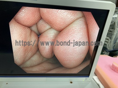 大腸スコープ&nbsp;|&nbsp;オリンパス&nbsp;|&nbsp;CF-H290Iの写真