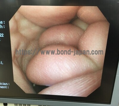 Video Gastroscope&nbsp;|&nbsp;OLYMPUS&nbsp;|&nbsp;GIF-XQ260