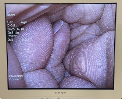 Endoscopy System&nbsp;|&nbsp;OLYMPUS&nbsp;|&nbsp;VISERA OTV-S7 Pro