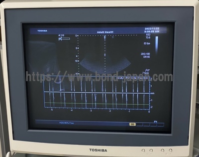 Color Doppler&nbsp;|&nbsp;CANON&nbsp;|&nbsp;SSA-660A Xario