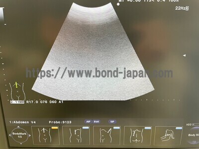 Color Doppler&nbsp;|&nbsp;HITACHI&nbsp;|&nbsp;F37