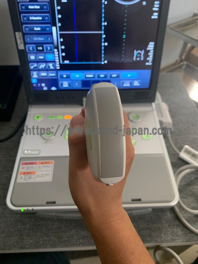 超音波診断装置/カラードプラ&nbsp;|&nbsp;キャノンメディカル株式会社&nbsp;|&nbsp;Viamo SSA-640Aの写真