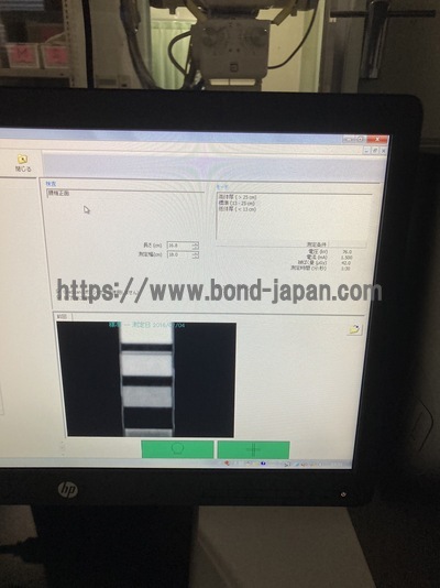 X-ray Bone Densitometer&nbsp;|&nbsp;GE&nbsp;|&nbsp;Prodigy