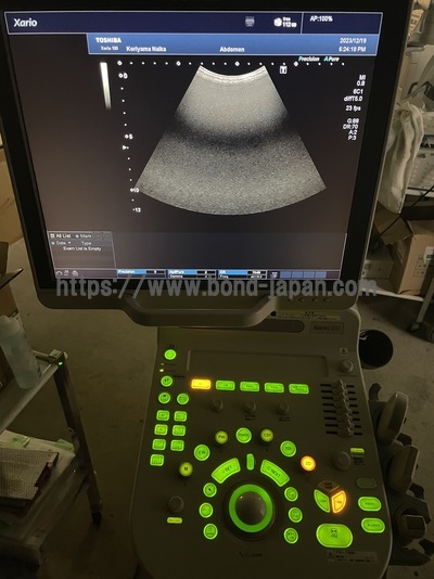 超音波診断装置/カラードプラ&nbsp;|&nbsp;キャノンメディカル株式会社&nbsp;|&nbsp;TUS-X100 Xario 100の写真