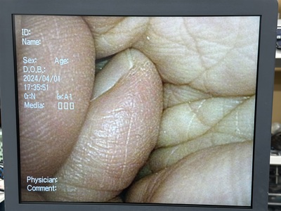 Laparoscope&nbsp;|&nbsp;OLYMPUS&nbsp;|&nbsp;LTF-VP