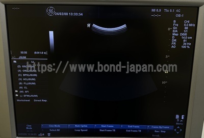 Color Doppler&nbsp;|&nbsp;GE&nbsp;|&nbsp;LOGIQ P5