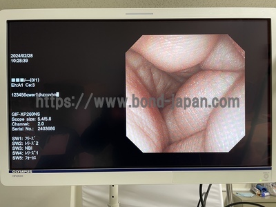 Video Gastroscope&nbsp;|&nbsp;OLYMPUS&nbsp;|&nbsp;GIF-XP260NS