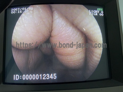 Video Colonoscope&nbsp;|&nbsp;FUJIFILM&nbsp;|&nbsp;EC-250WM