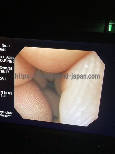 Processor&nbsp;|&nbsp;OLYMPUS&nbsp;|&nbsp;CV-260