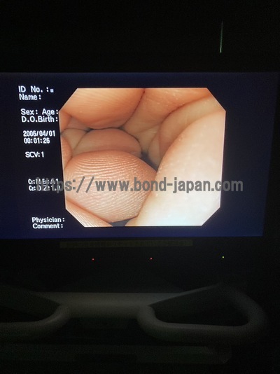 Endoscopy System&nbsp;|&nbsp;OLYMPUS&nbsp;|&nbsp;LUCERA CV-260SL