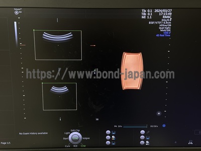 4D Ultrasound&nbsp;|&nbsp;GE&nbsp;|&nbsp;Voluson E10 BT17