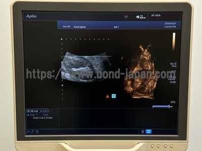 Color Doppler&nbsp;|&nbsp;CANON&nbsp;|&nbsp;Aplio 300