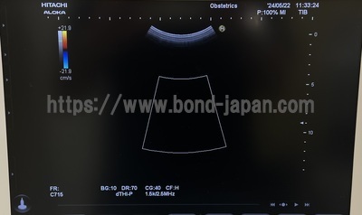 Ultrasound&nbsp;|&nbsp;HITACHI&nbsp;|&nbsp;Noblus