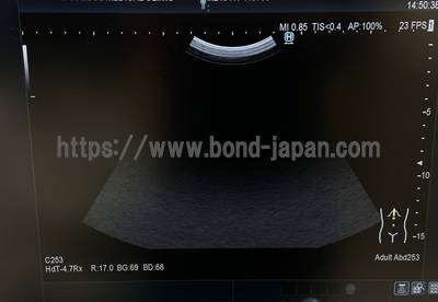 超音波診断装置&nbsp;|&nbsp;日立製作所&nbsp;|&nbsp;Arietta 65の写真