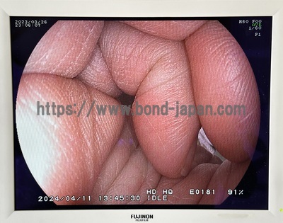 Endoscopy System (FICE)&nbsp;|&nbsp;FUJIFILM&nbsp;|&nbsp;EPX-4400