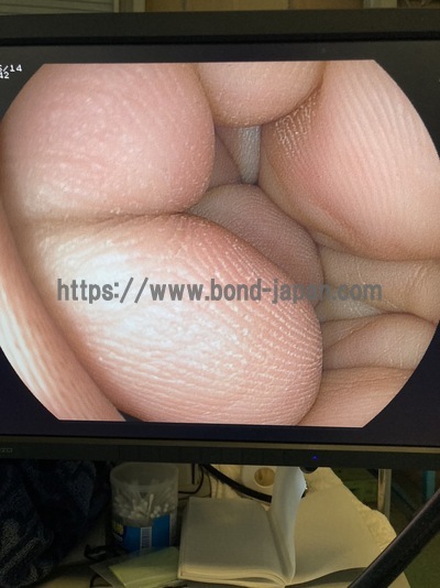 Gastroscope&nbsp;|&nbsp;FUJIFILM&nbsp;|&nbsp;EG-590WR