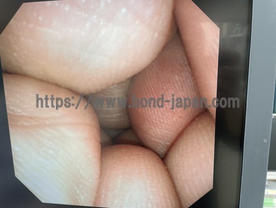 Endoscopy System&nbsp;|&nbsp;OLYMPUS&nbsp;|&nbsp;LUCERA CV-260SL