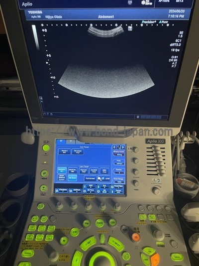 Color Doppler&nbsp;|&nbsp;CANON&nbsp;|&nbsp;Aplio 300