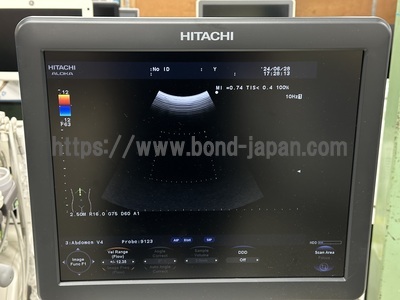 Color Doppler&nbsp;|&nbsp;HITACHI&nbsp;|&nbsp;F37