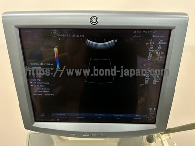 Color Doppler&nbsp;|&nbsp;GE&nbsp;|&nbsp;LOGIQ P5