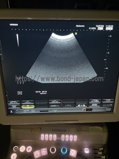 Color Doppler&nbsp;|&nbsp;HITACHI&nbsp;|&nbsp;Hi Vision Avius