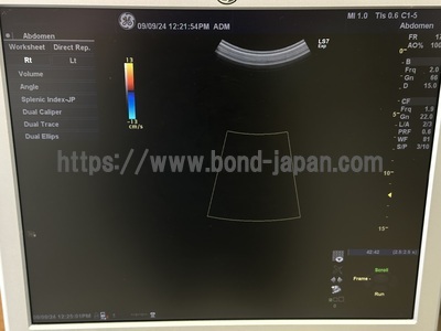 Color Doppler&nbsp;|&nbsp;GE&nbsp;|&nbsp;Logiq S7 Expert