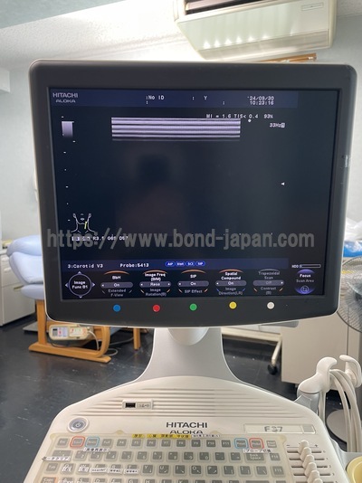 Color Doppler&nbsp;|&nbsp;HITACHI&nbsp;|&nbsp;F37
