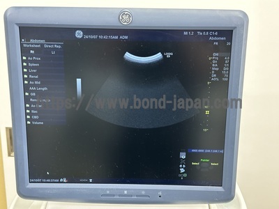 Color Doppler&nbsp;|&nbsp;GE&nbsp;|&nbsp;LOGIQ E9