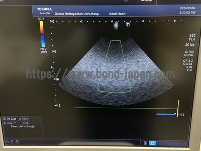 4D Ultrasound&nbsp;|&nbsp;CANON&nbsp;|&nbsp;Aplio 500