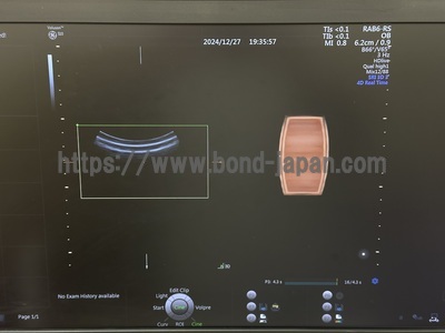 4D Ultrasound&nbsp;|&nbsp;GE&nbsp;|&nbsp;Voluson S10 BT16