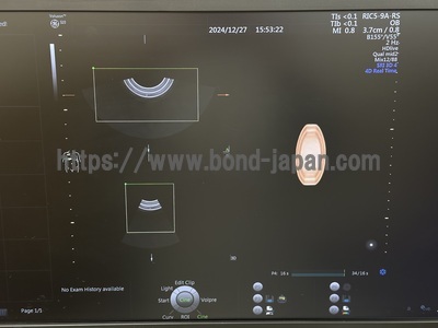 4D Ultrasound&nbsp;|&nbsp;GE&nbsp;|&nbsp;Voluson S10 BT16
