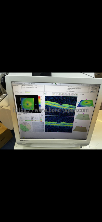 OCT&nbsp;|&nbsp;Carl Zeiss&nbsp;|&nbsp;Cirrus 5000 HD-OCT