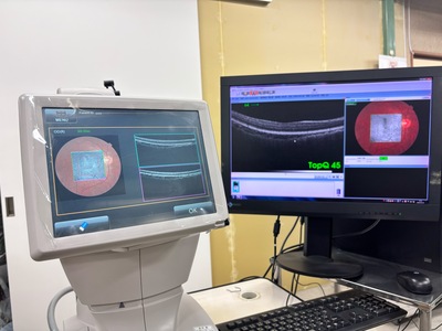 OCT&nbsp;|&nbsp;TOPCON&nbsp;|&nbsp;3D OCT 1 / Maestro 1
