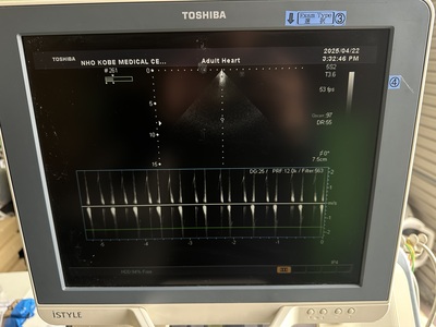 Color Doppler&nbsp;|&nbsp;CANON&nbsp;|&nbsp;SSA-660A Xario
