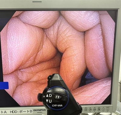 Cystoscope&nbsp;|&nbsp;OLYMPUS&nbsp;|&nbsp;CYF-VHA